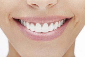 Teeth whitening